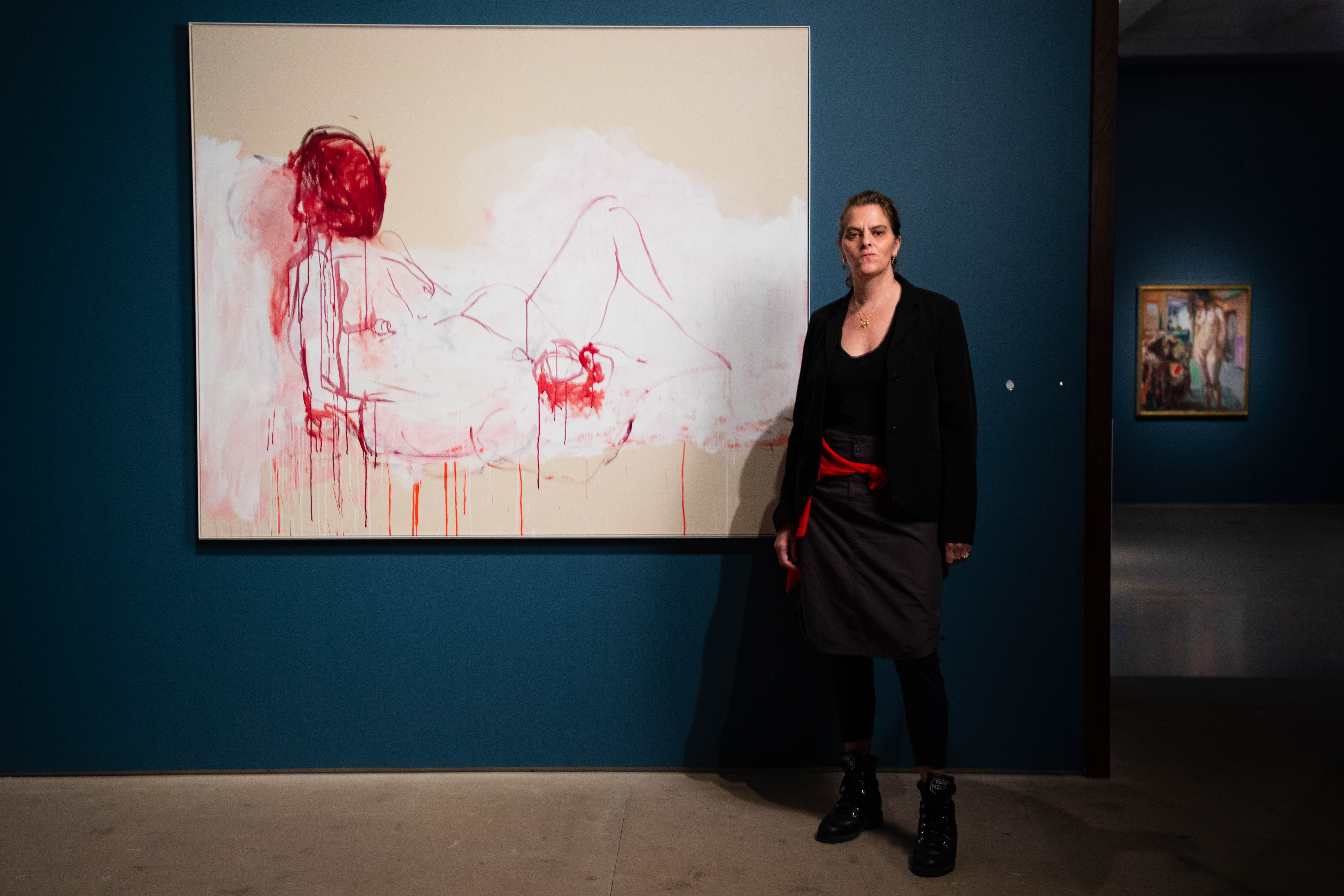 Tracey Emin wants to “live forward” after bladder cancer diagnosis