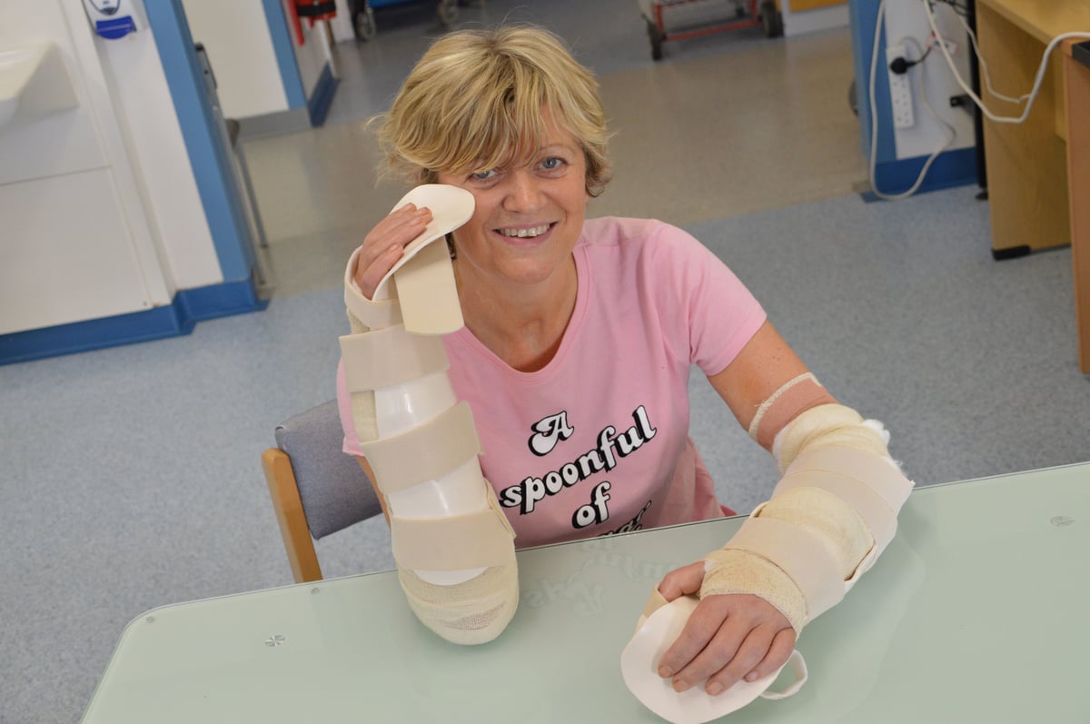 Woman who had double hand transplant after almost fatal pneumonia and sepsis hails ‘phenomenal’ progress