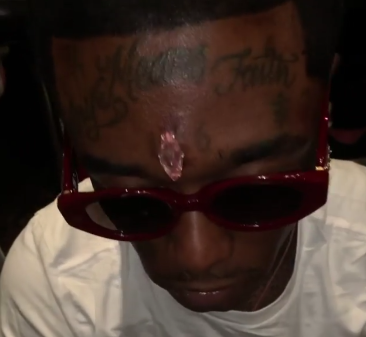 Rapper Lil Uzi Vert has $24 Million pink diamond embedded in his forehead