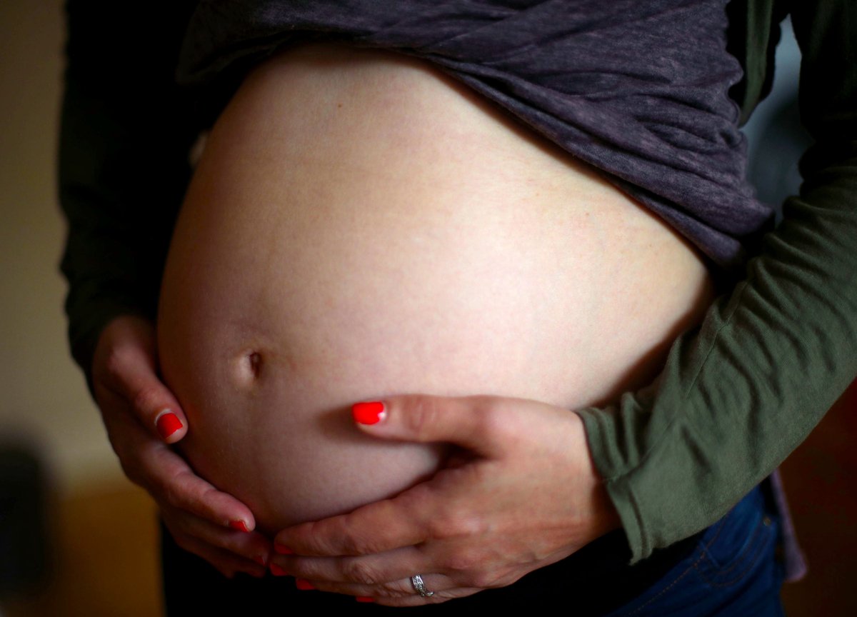 Iron deficiency anaemia in early pregnancy raises risk of heart defects – study
