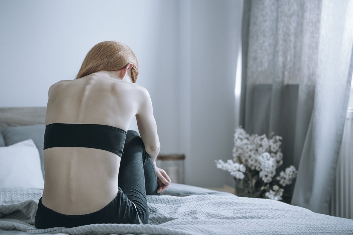 Alarm sounded over Covid-fuelled rise in eating disorders among young