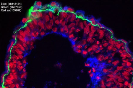 ‘Amazon of antibodies’ Abcam buys up US supplier in $340million deal 