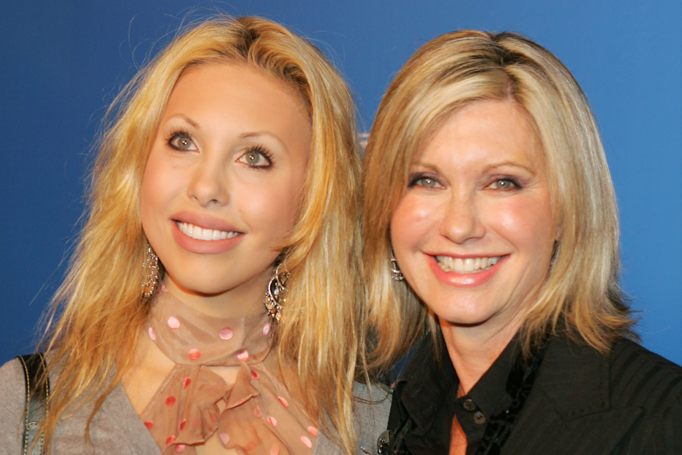 Olivia Newton-John’s daughter Chloe reverses cosmetic procedures