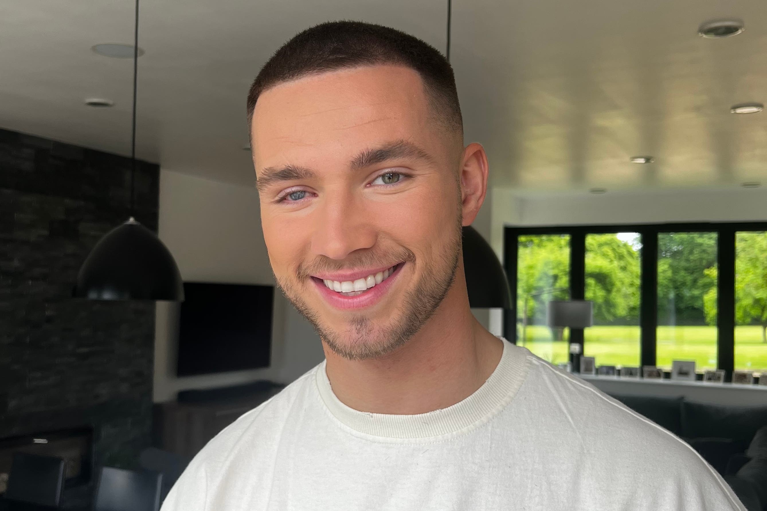 Partially sighted Love Island finalist Ron Hall becomes blind charity ambassador