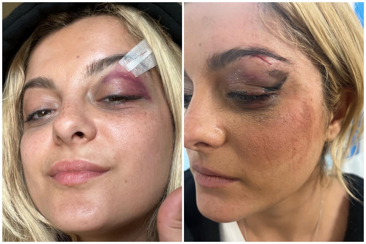 Man charged with assault after Bebe Rexha hit in the face during New York gig