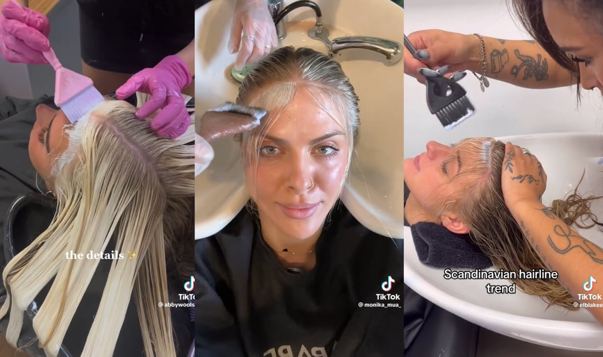 The Scandinavian hairline TikTok trend: It’s not as risk-free as you think