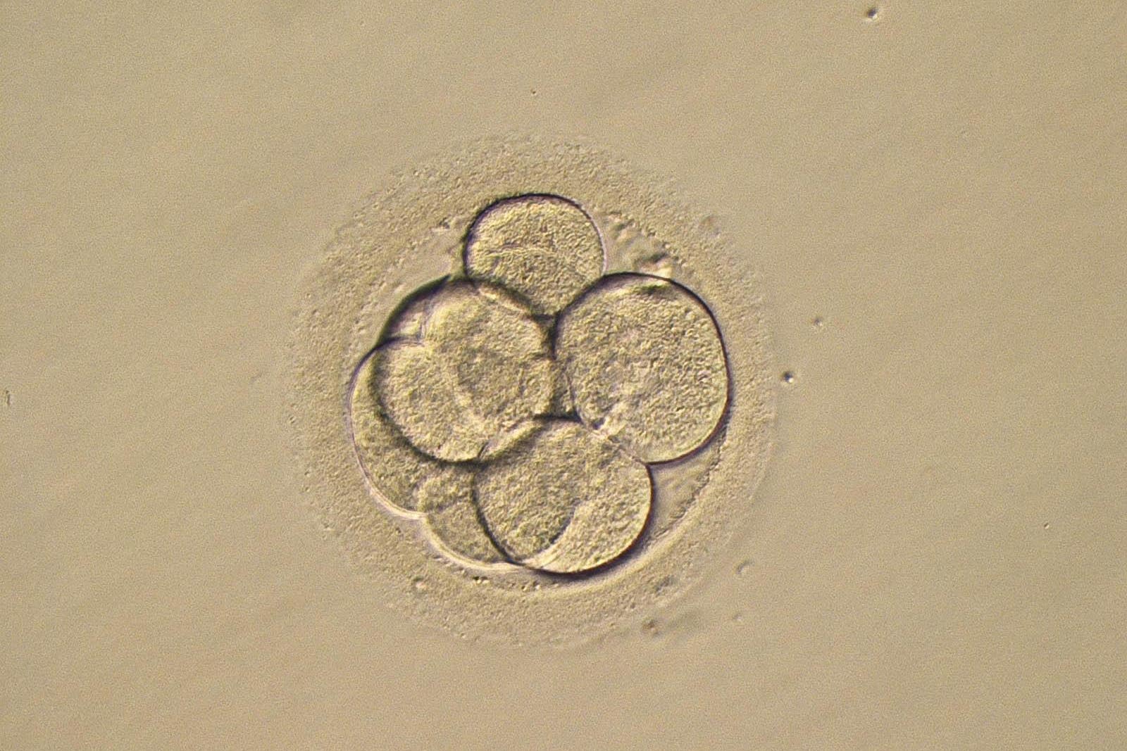 Alabama hospital puts IVF on pause after frozen embryo ruling
