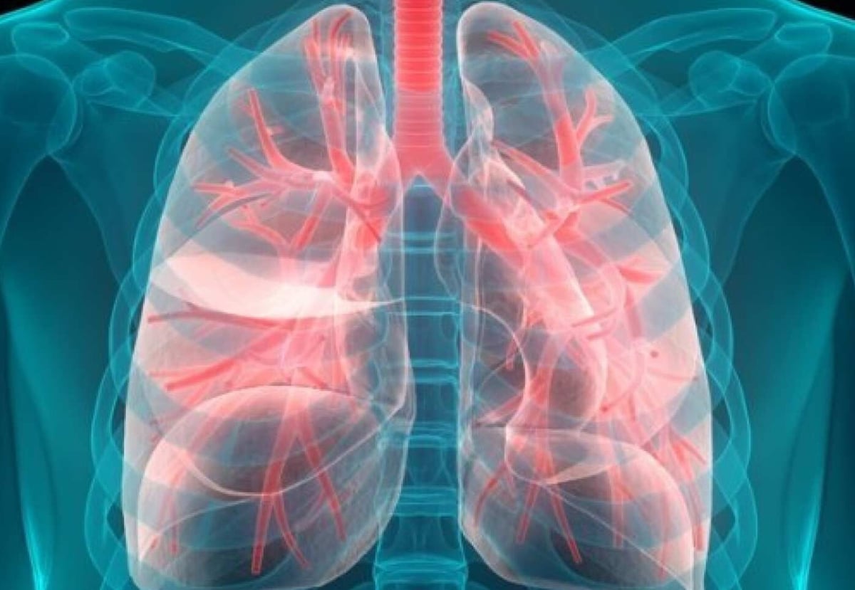 The algorithm will see you now... London scientists use 'virtual biopsy' to diagnose lung cancer