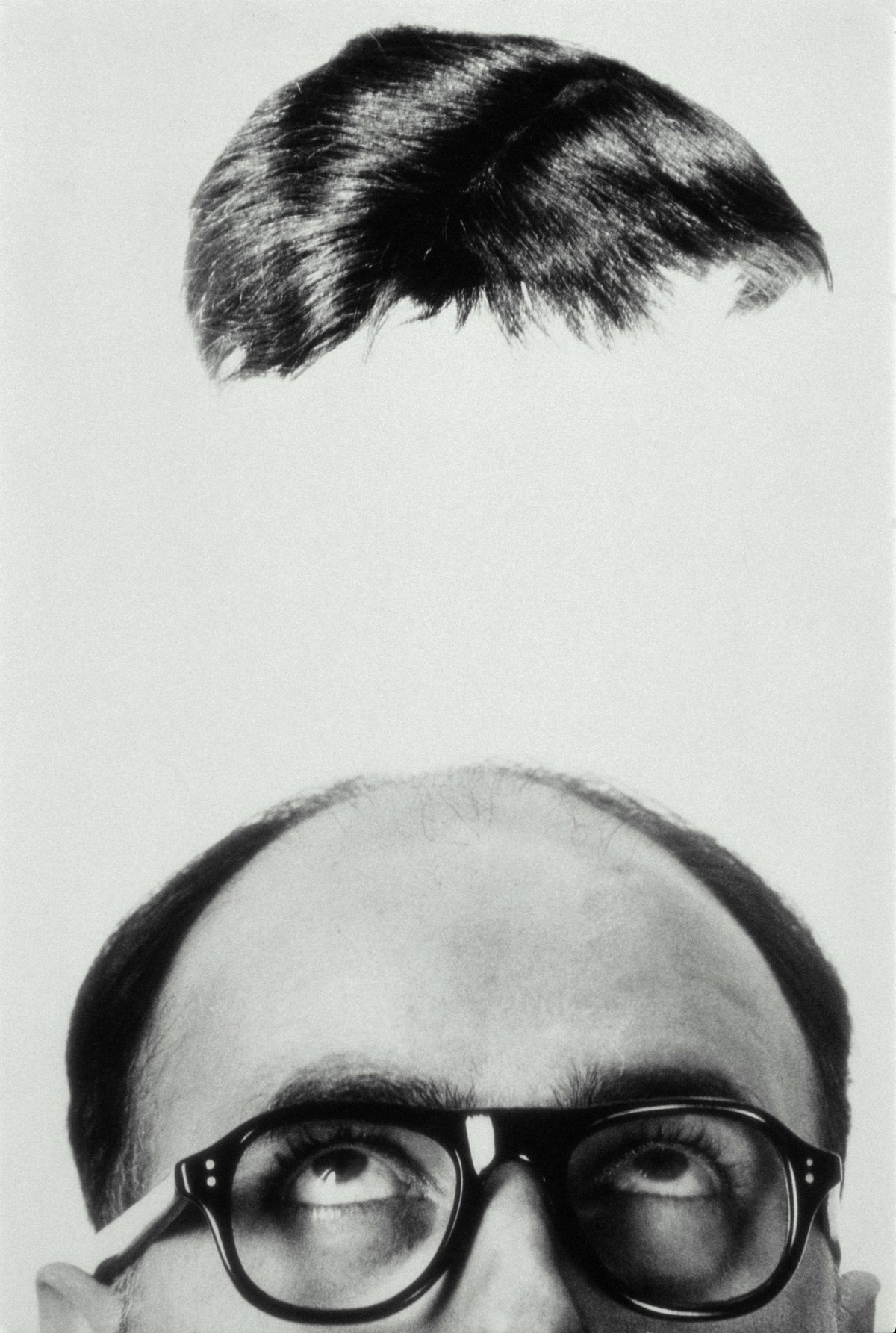 The Bald Truth: how hair loss is more traumatic than you think