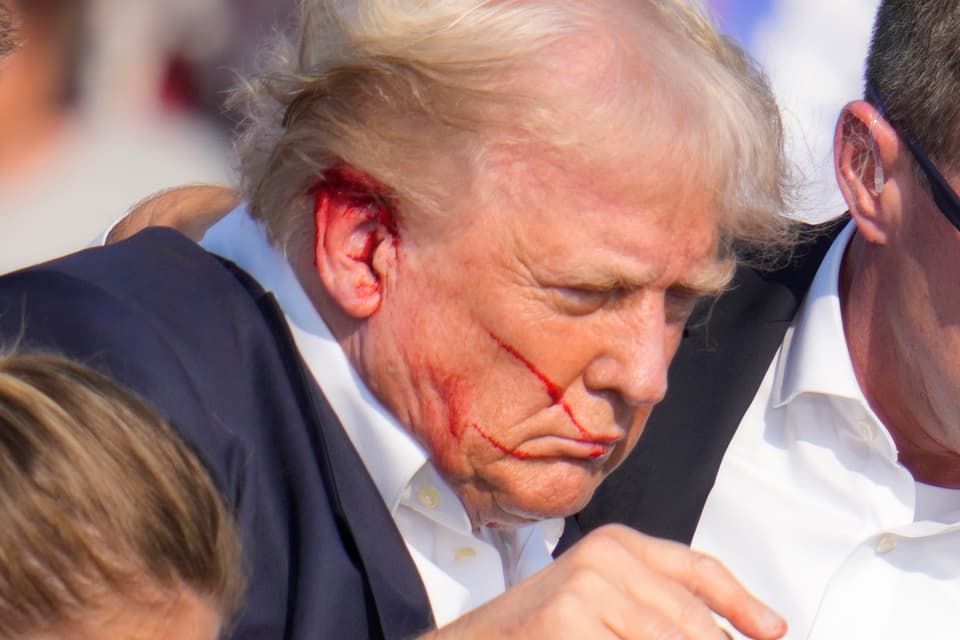 <p>Pictures showed blood on Donald Trump’s right ear and part of his face after shots were fired during the rally (Gene J Puskar/AP)</p>
