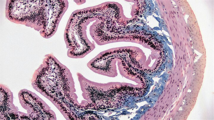 How to improve your brain health: from diet to meditations
