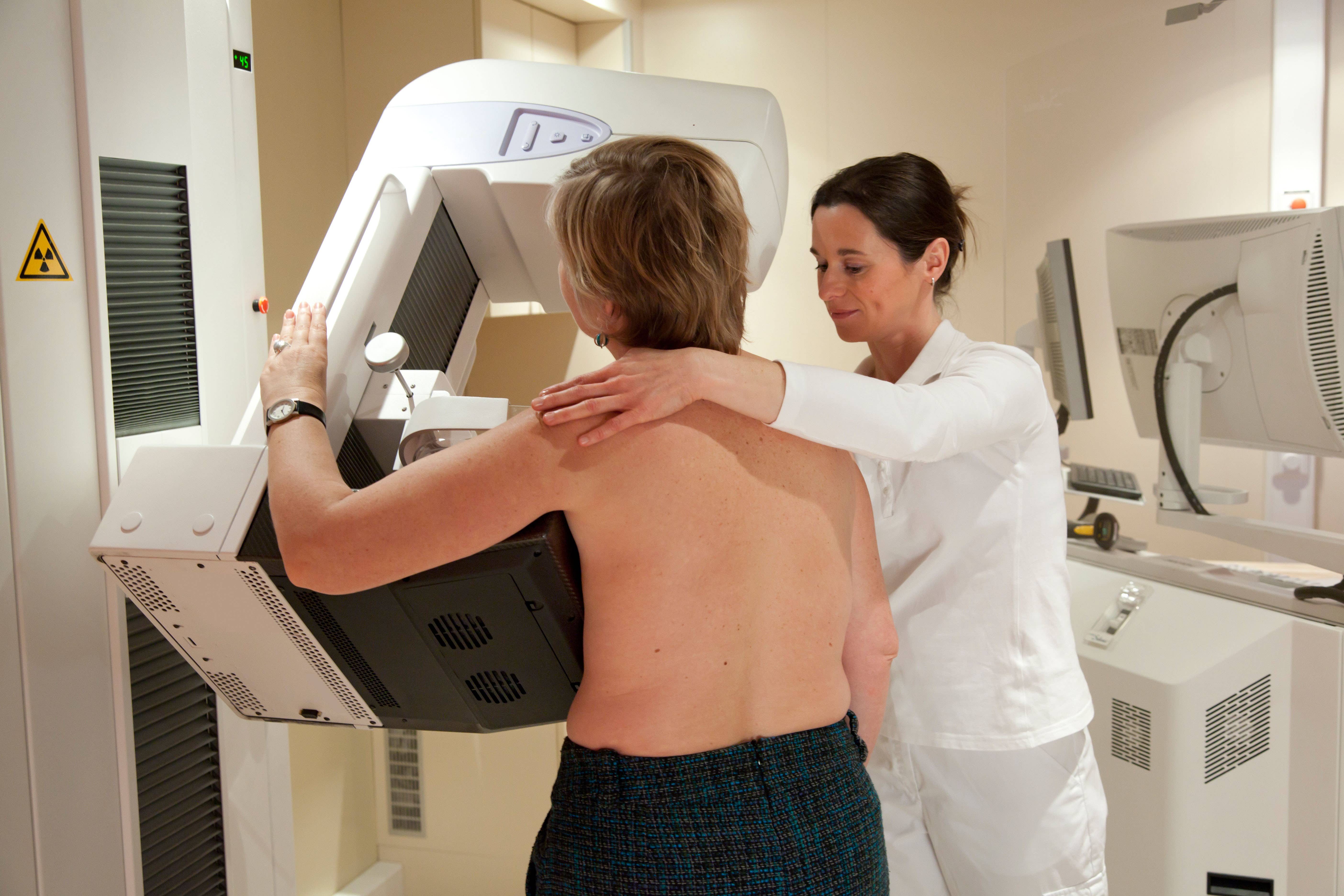 Call for risk-based breast cancer screening as cases in under 50s rise