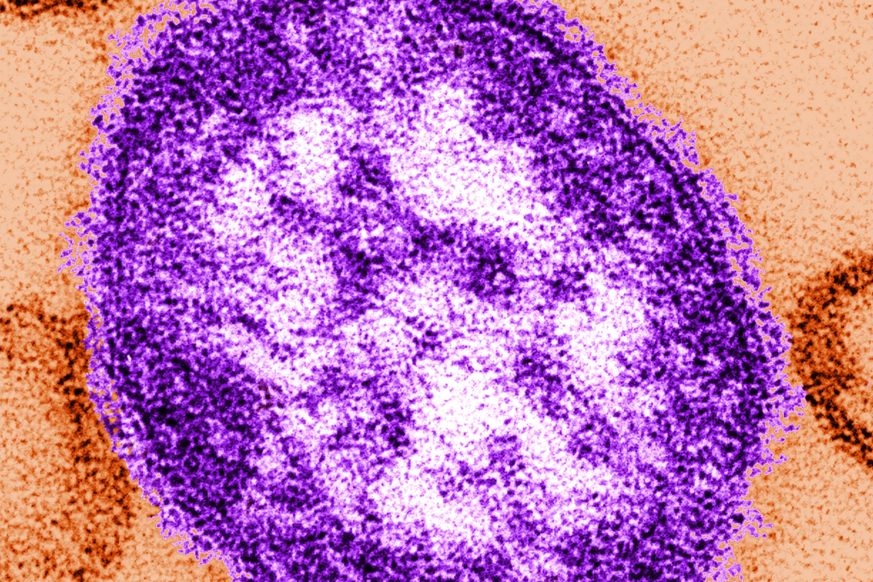 Adult dies of measles as new cases recorded in London