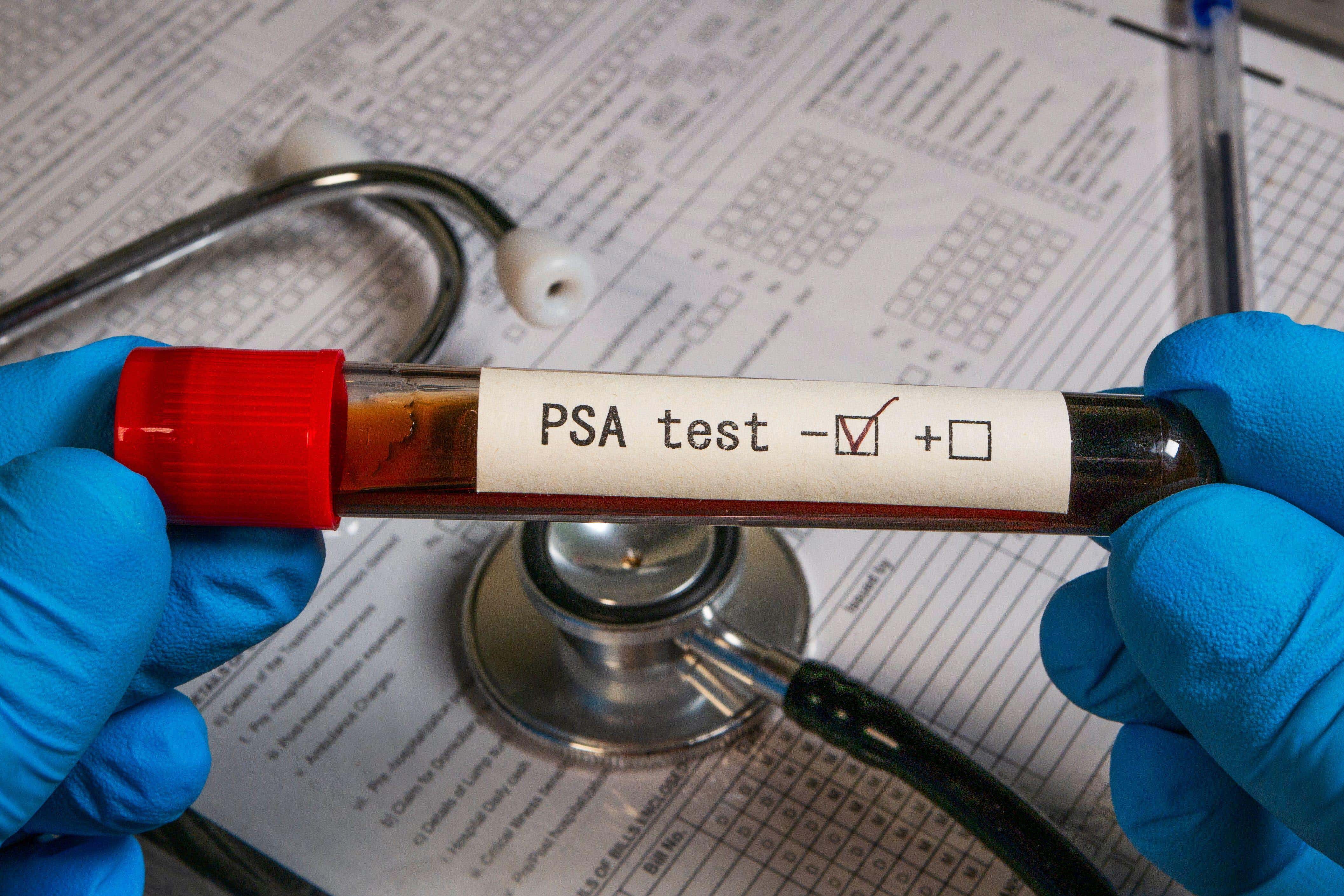 Study shows prostate cancer screening can ‘reduce deaths’ as UK scheme assessed