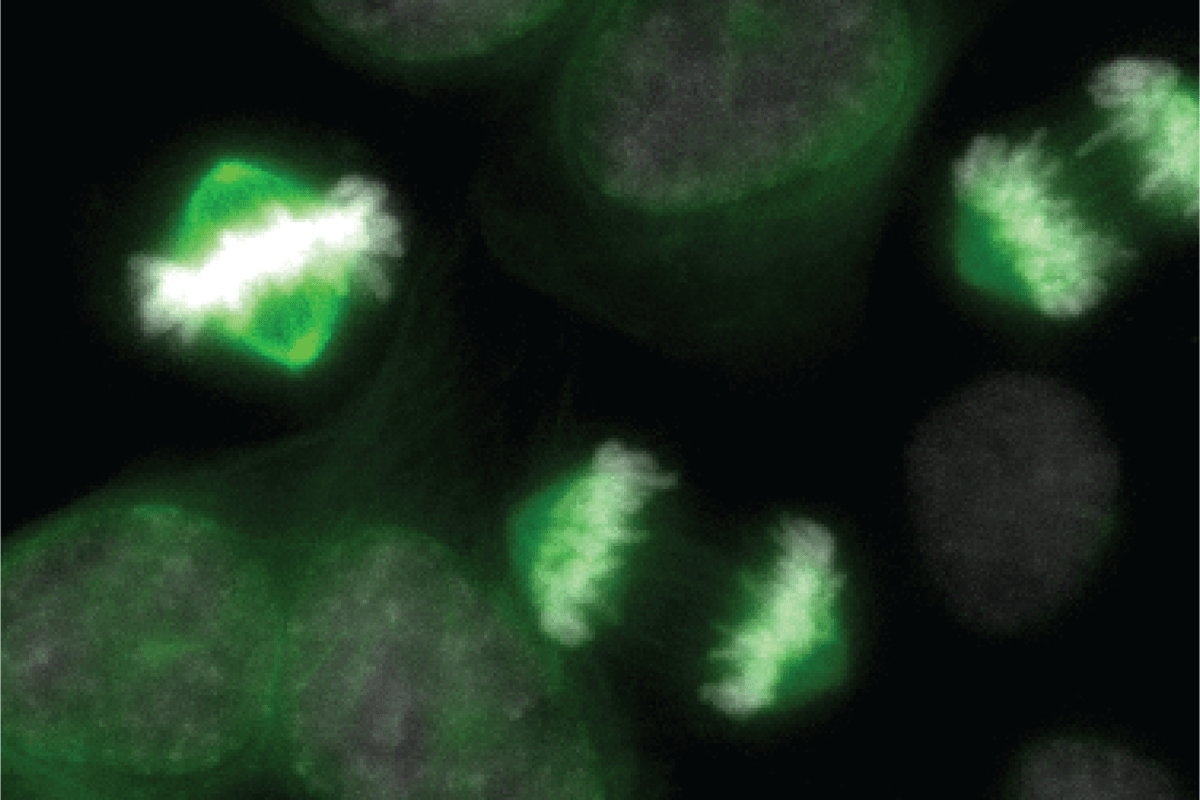 Study of cellular ‘light switches’ could spark new cancer treatments