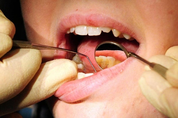Your dentist could be ripping you off (but don’t say anything until after treatment) | London Evening Standard