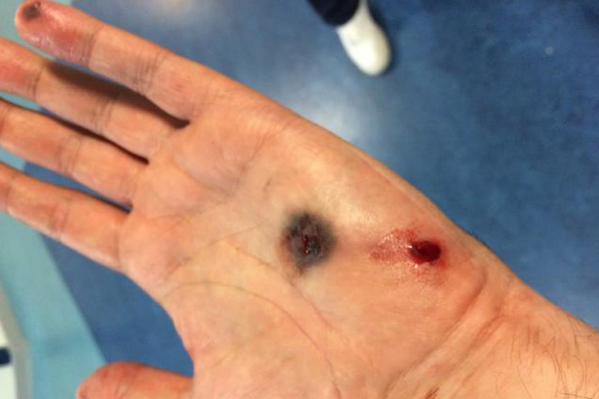 Jailed: man who shot police officer through hand with gun he claimed was a toy | London Evening Standard