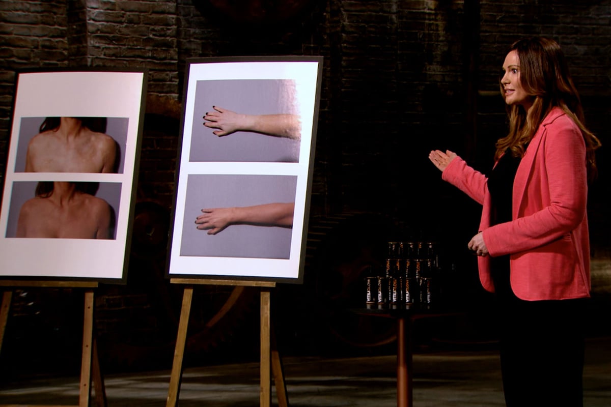 Dragons’ Den 2015: Vitiliglow could be a life-changing product for people with vitiligo, from Episode 5 | London Evening Standard