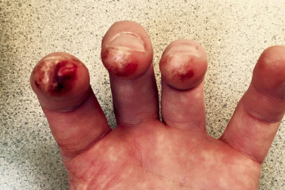 Famous violinist posts pictures of bloodied hands after concert | London Evening Standard