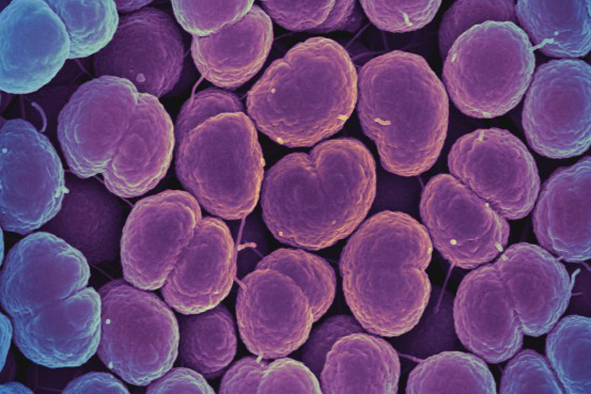 Brexit could lead to spread of infectious diseases such as super-gonorrhoea, health chief warns | London Evening Standard