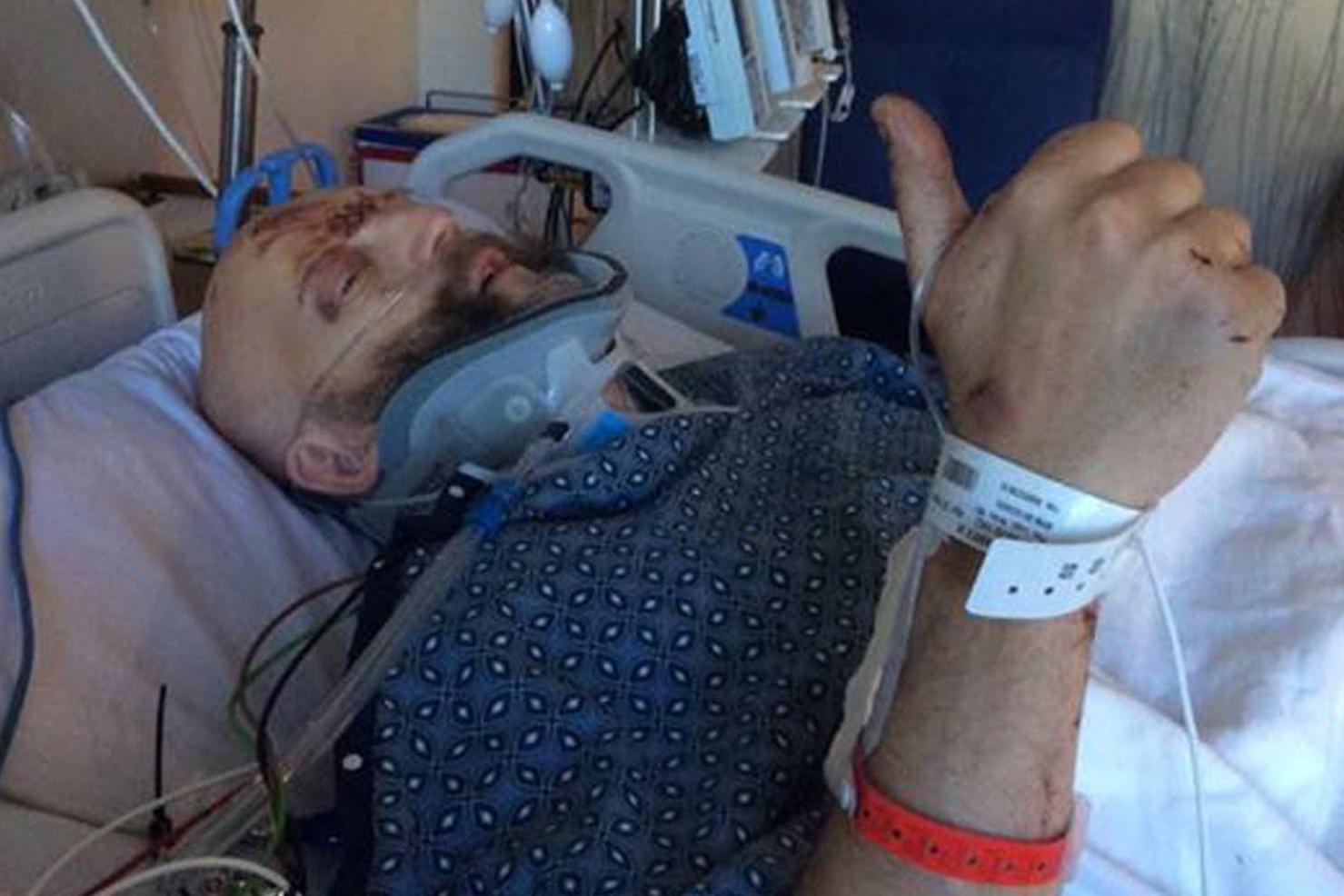 Harry Potter actor in intensive care after horror car crash