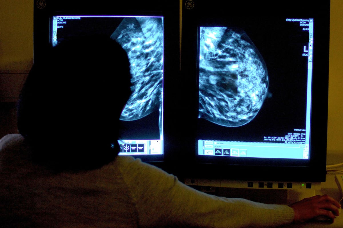 NHS approves 'breakthrough' breast cancer drug which could extend thousands of women's lives | London Evening Standard