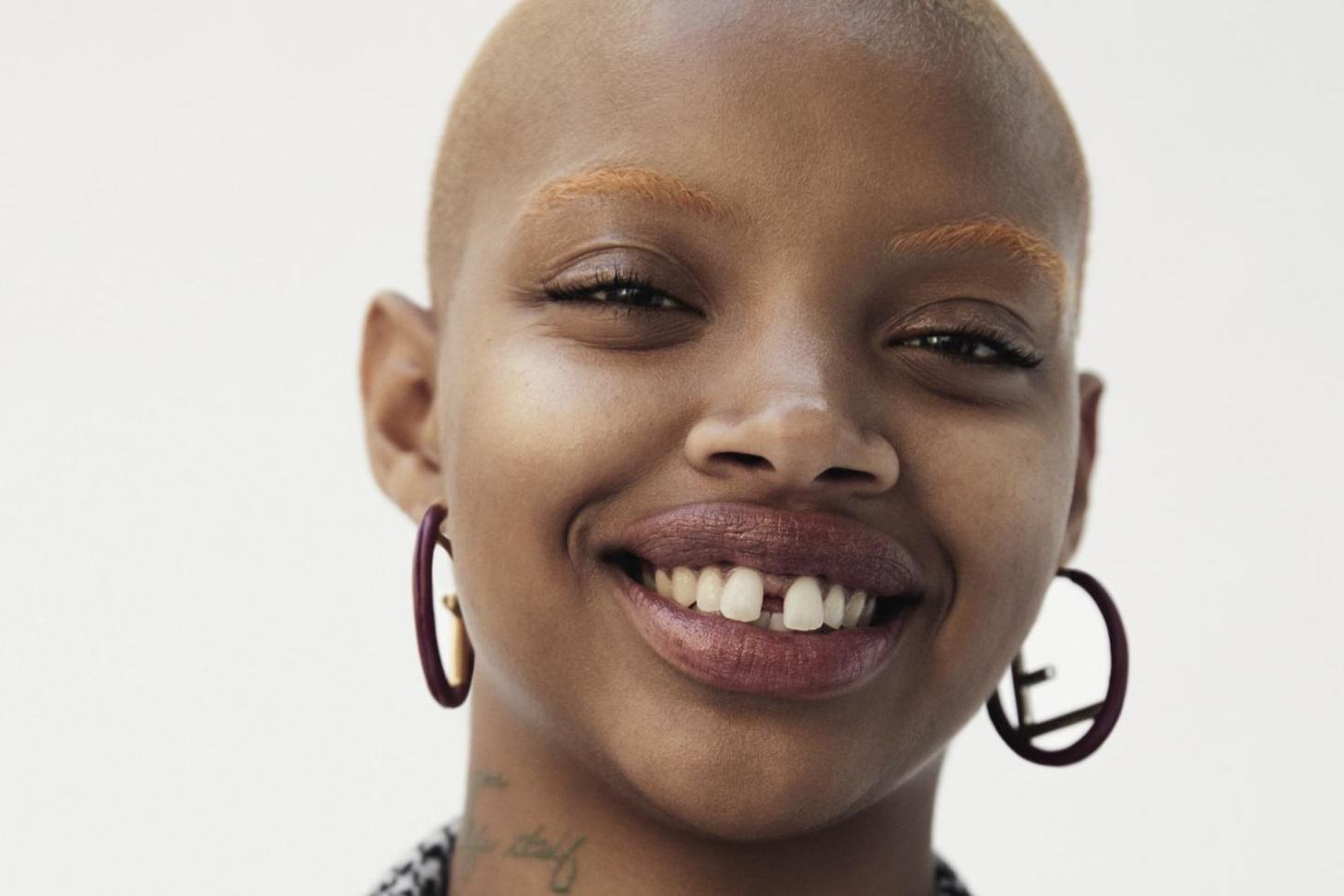 Meet Slick Woods, the model taking the world by storm