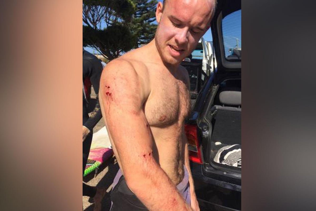 British doctor tells how he punched a shark 'in the face' to escape being eaten | London Evening Standard
