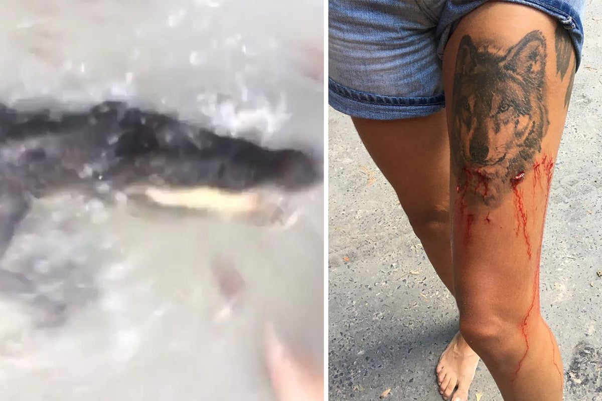 British woman attacked by crocodile in Australia: I saw blood running down and I ran | London Evening Standard