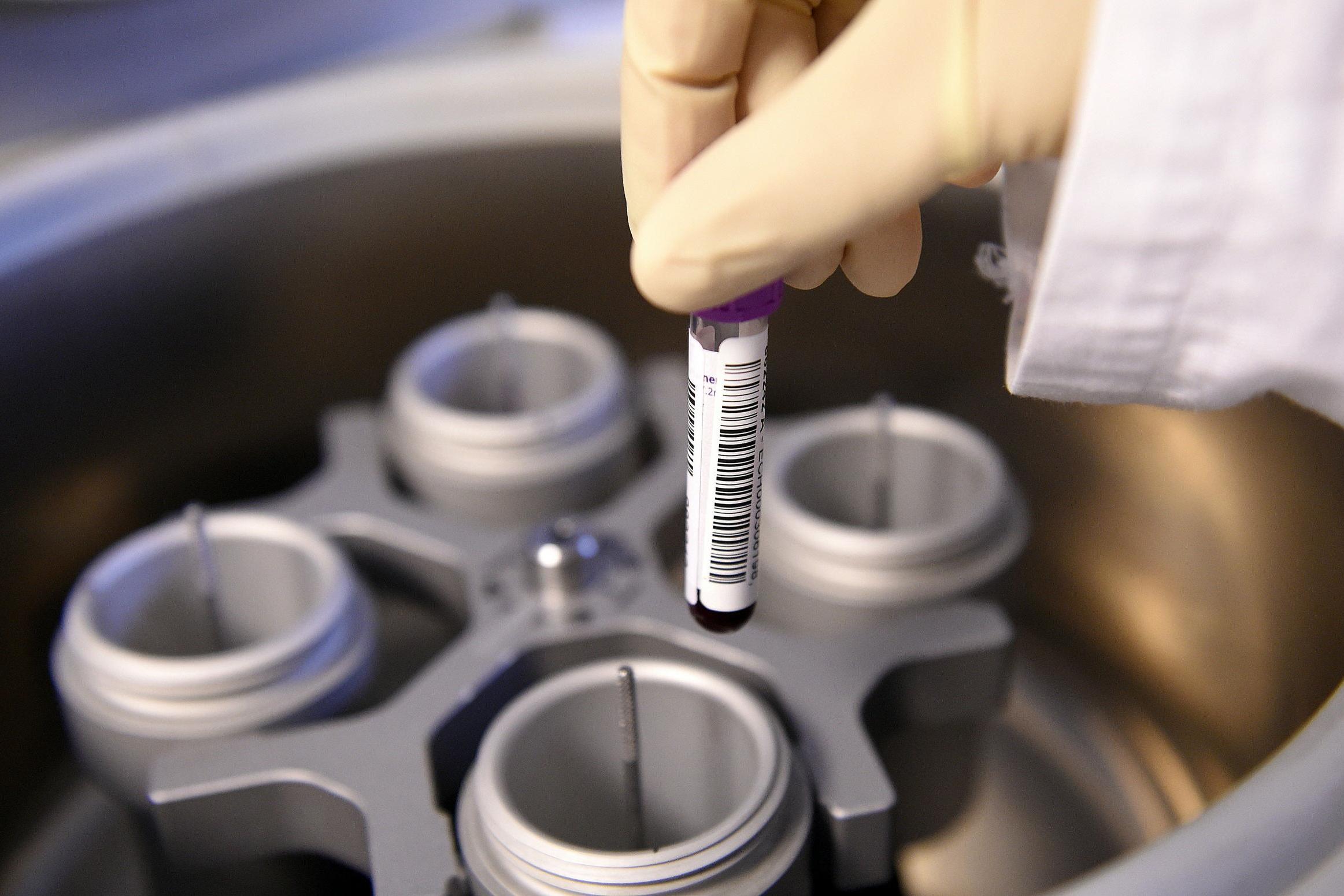 Wada investigate issues with new doping test sample bottles