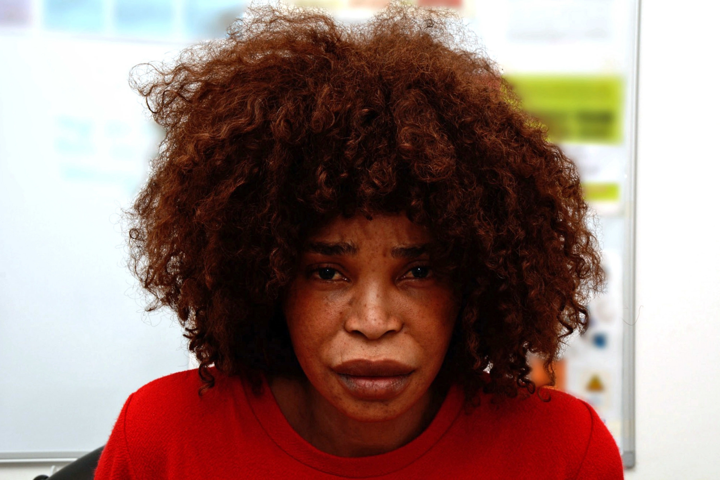 Woman jailed for 12 years for horrific acid attack on ex-boyfriend