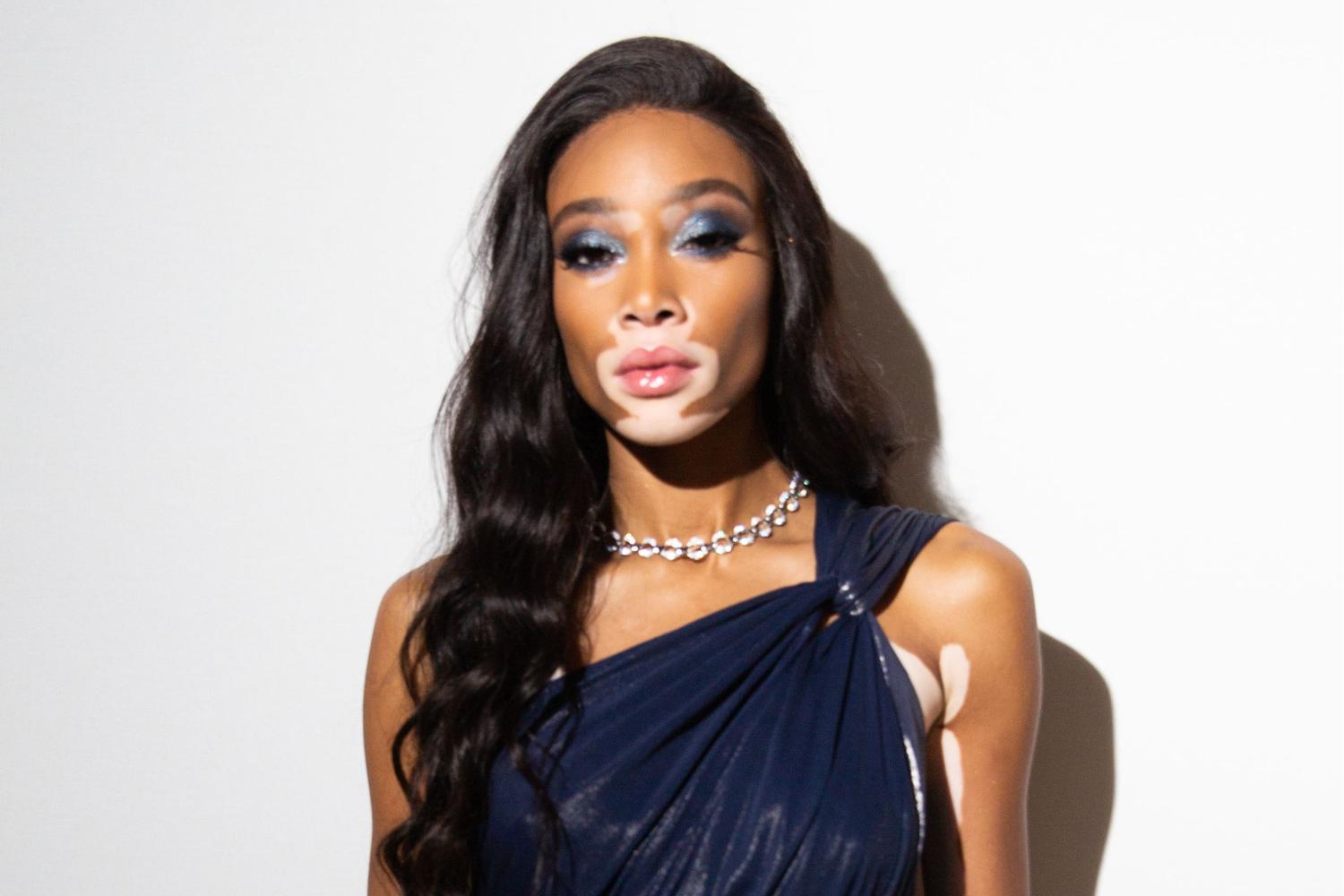 Winnie Harlow is the latest model to join the Victoria's Secret gang