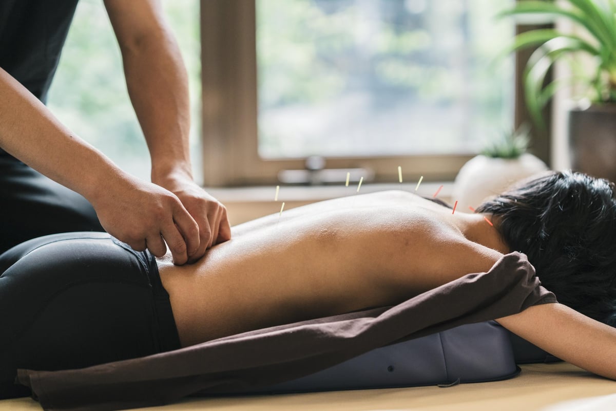 London’s Best Acupuncturists