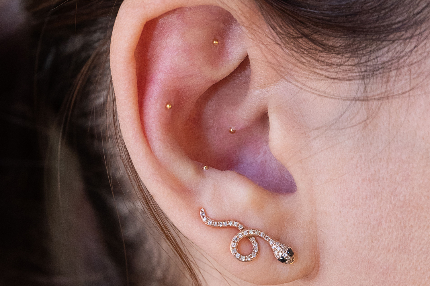 Why ear seeds are the new wellness trend you should try