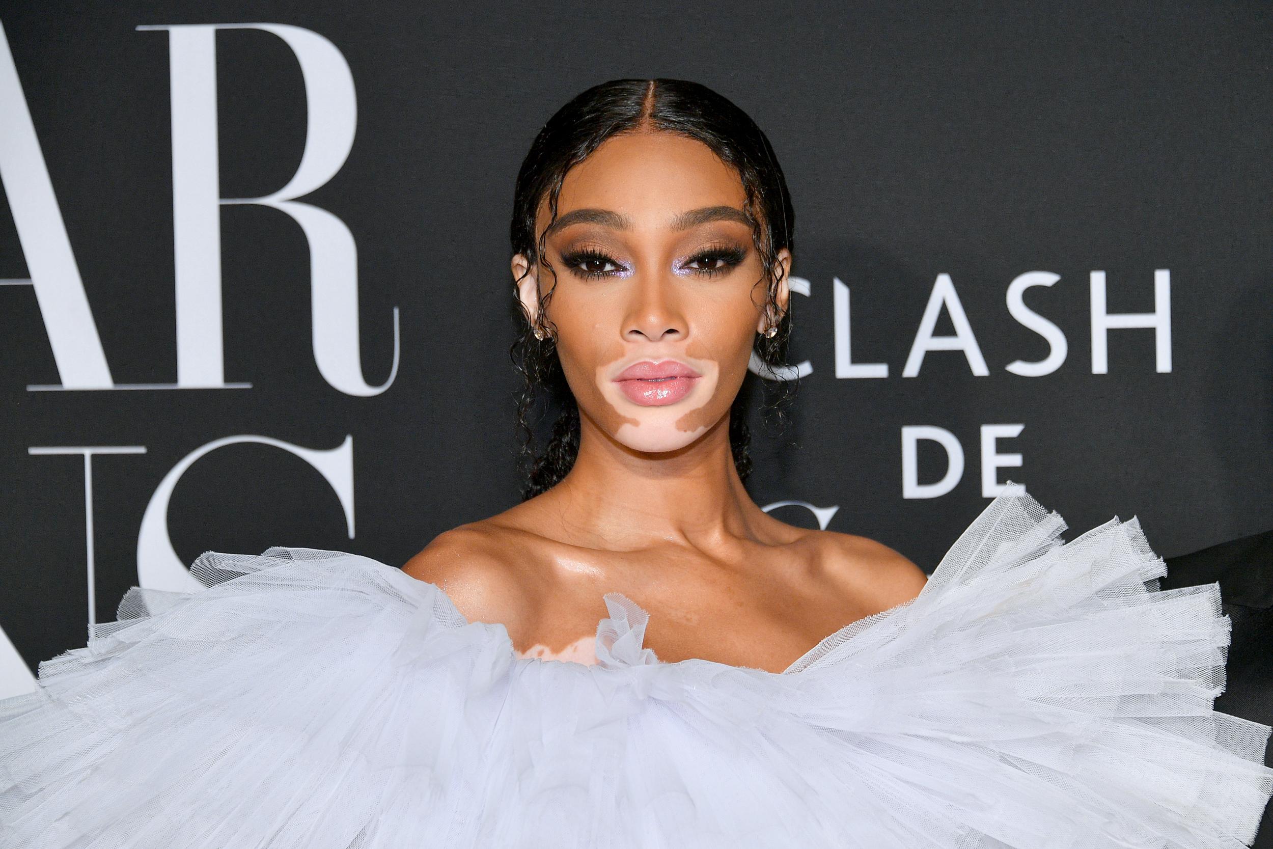 Winnie Harlow responds to criticism after sharing economy class photo
