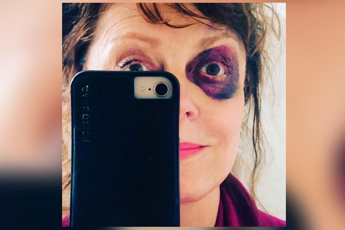 Susan Sarandon reveals shocking black eye after falling over and fracturing her nose | London Evening Standard