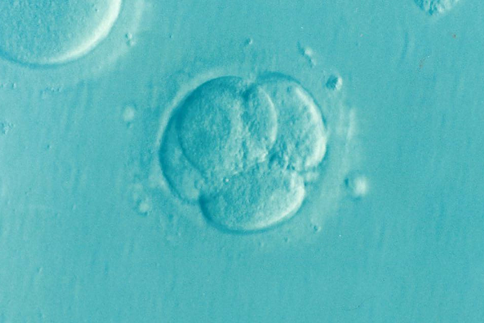 Discrepancies in wait times for NHS fertility services across London