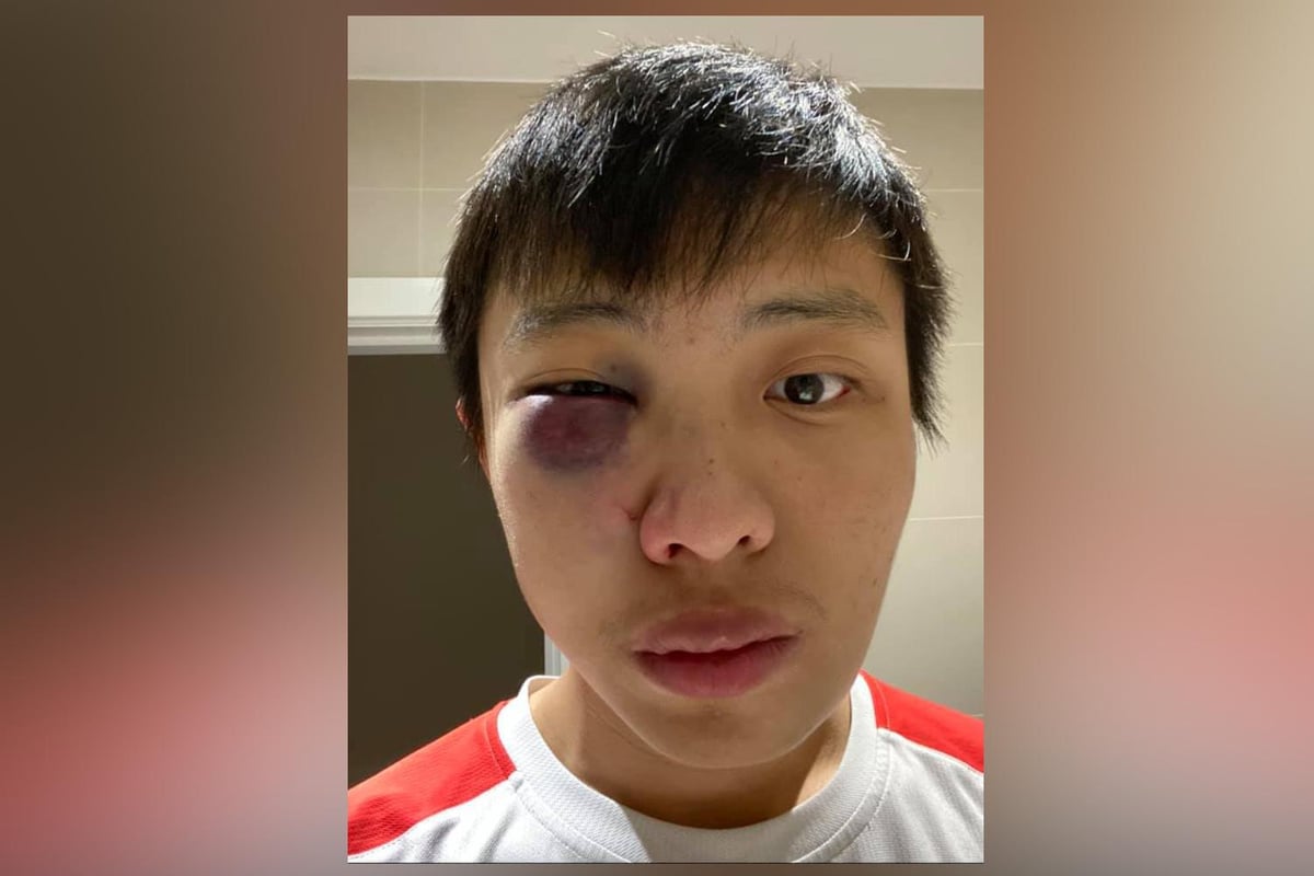 Coronavirus: Police charge teenager over racially-aggravated Oxford Street assault | London Evening Standard