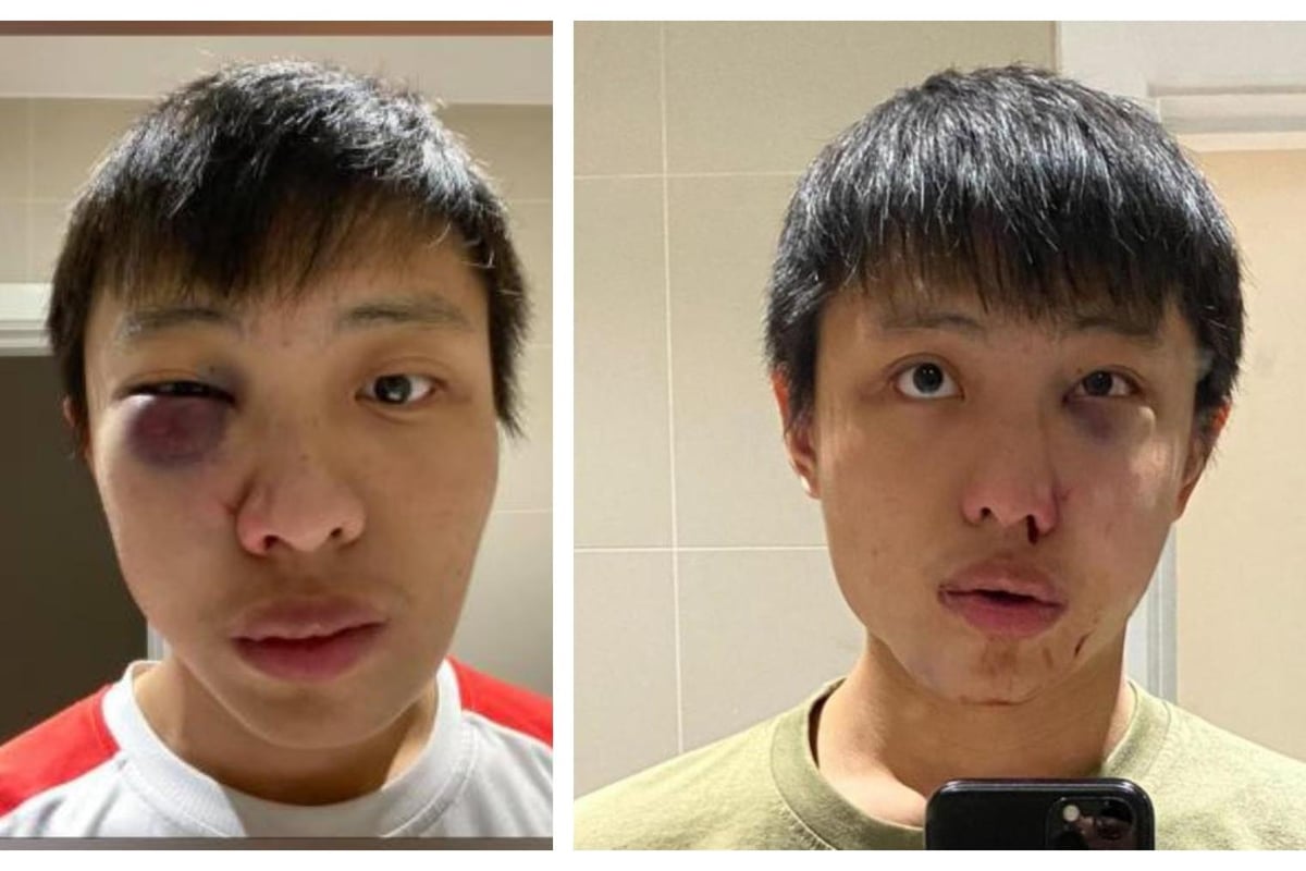 Oxford Street attack on Singaporean student over Covid was ‘unprovoked and racially motivated’