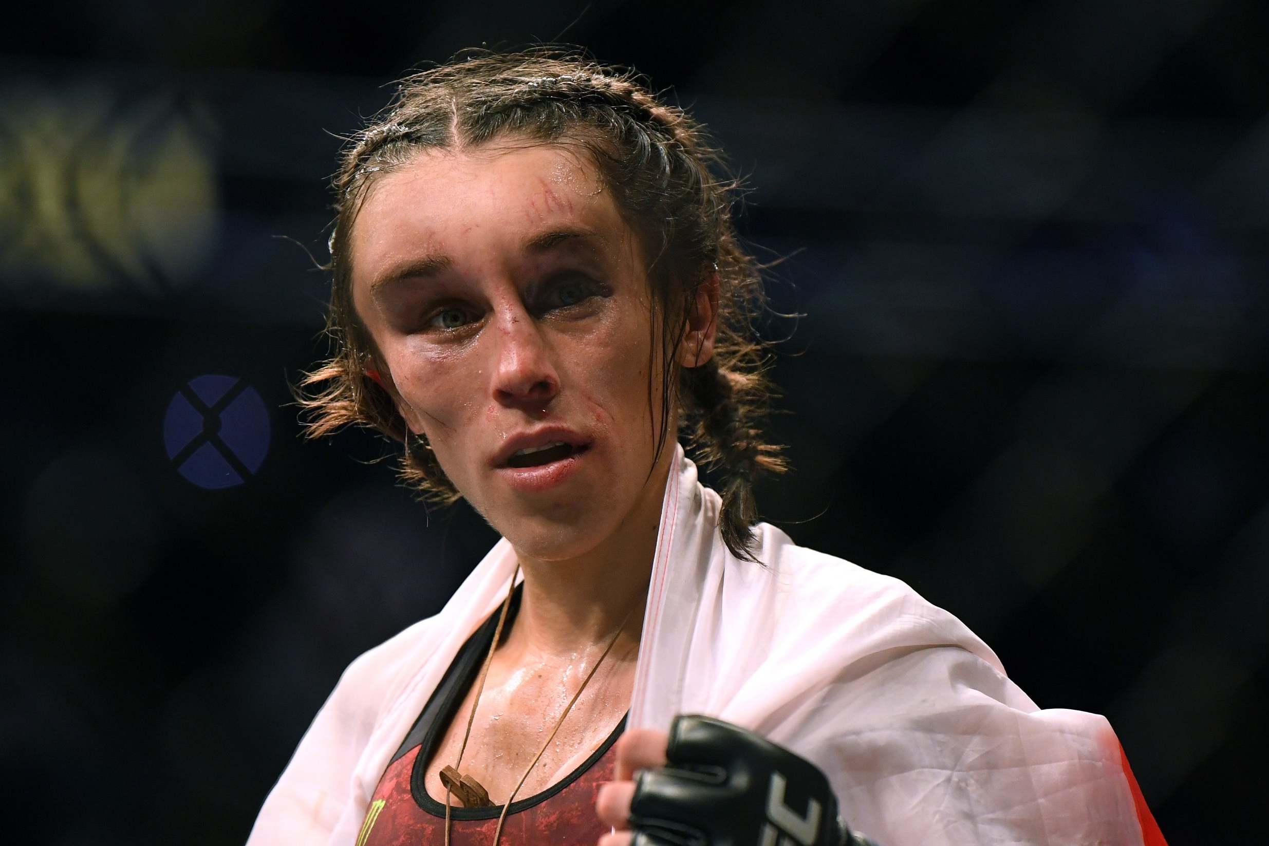 Joanna Jedrzejczyk suffers gruesome head injury in Zhang defeat