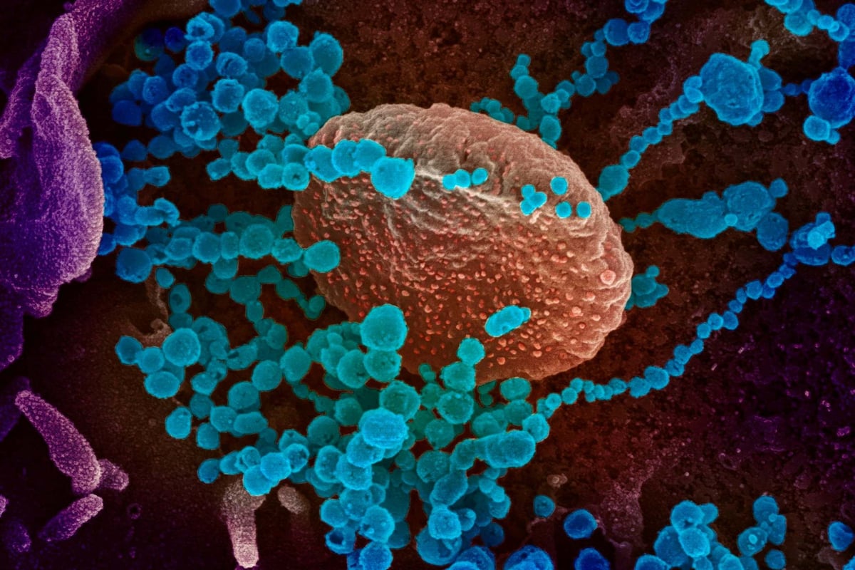 Studies on coronavirus ‘good news for vaccine work’ | London Evening Standard
