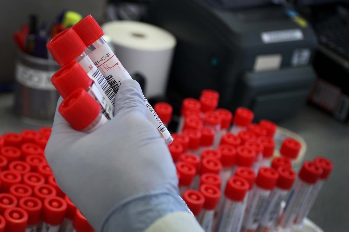 Breakthrough Roche antibody test to be rushed to NHS staff and carers | London Evening Standard