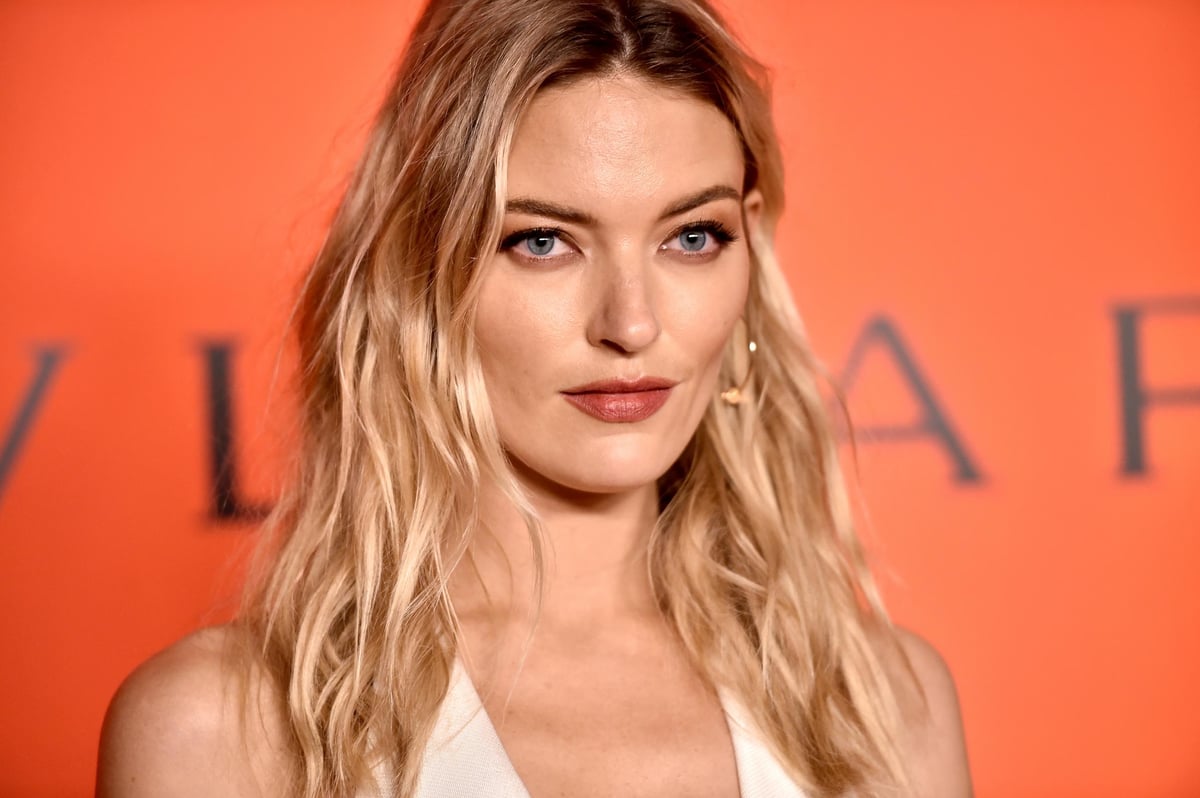 Martha Hunt: 'Scoliosis is the driving force of my modeling career' | London Evening Standard