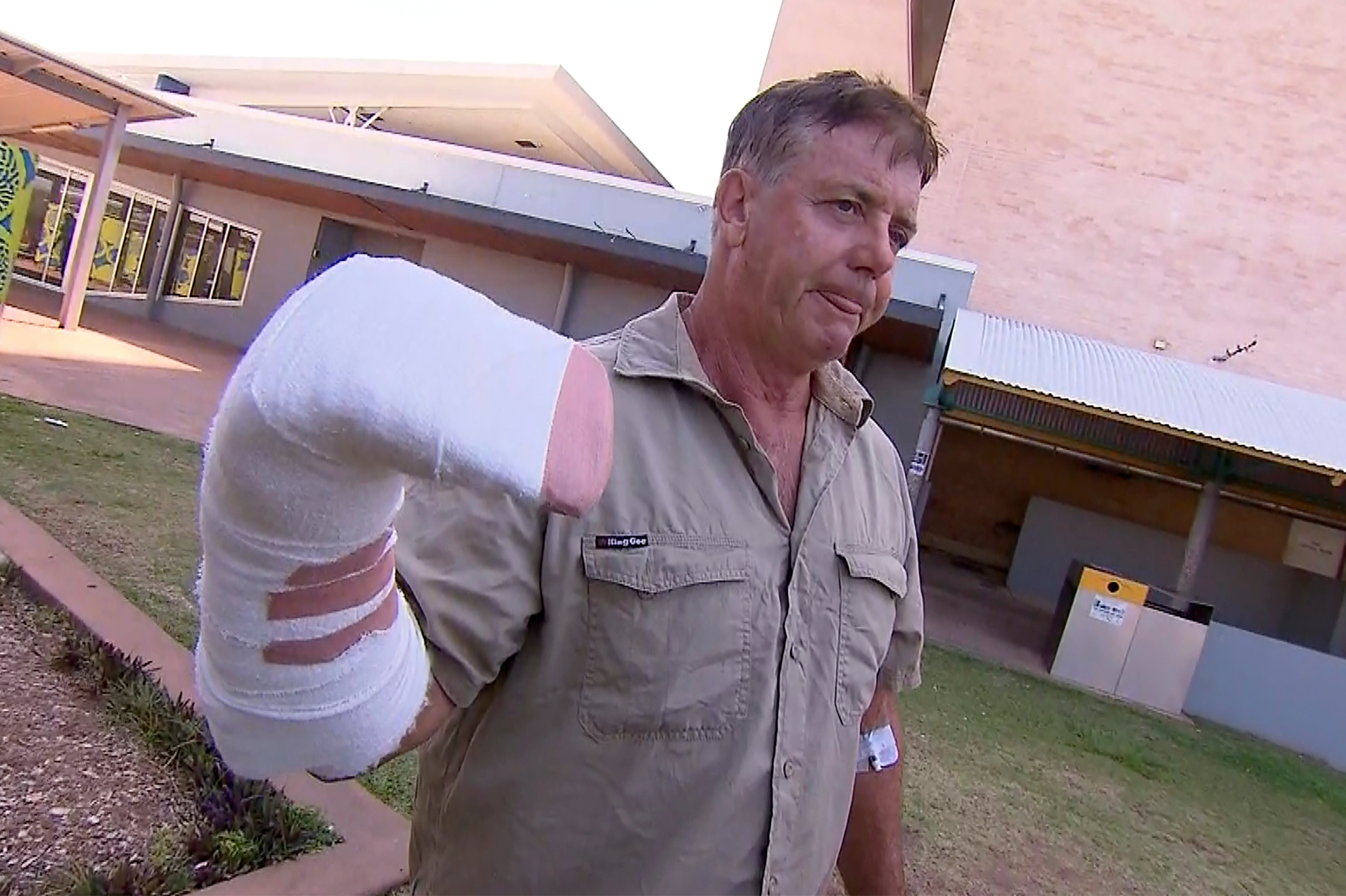 Crocodile attack Australia