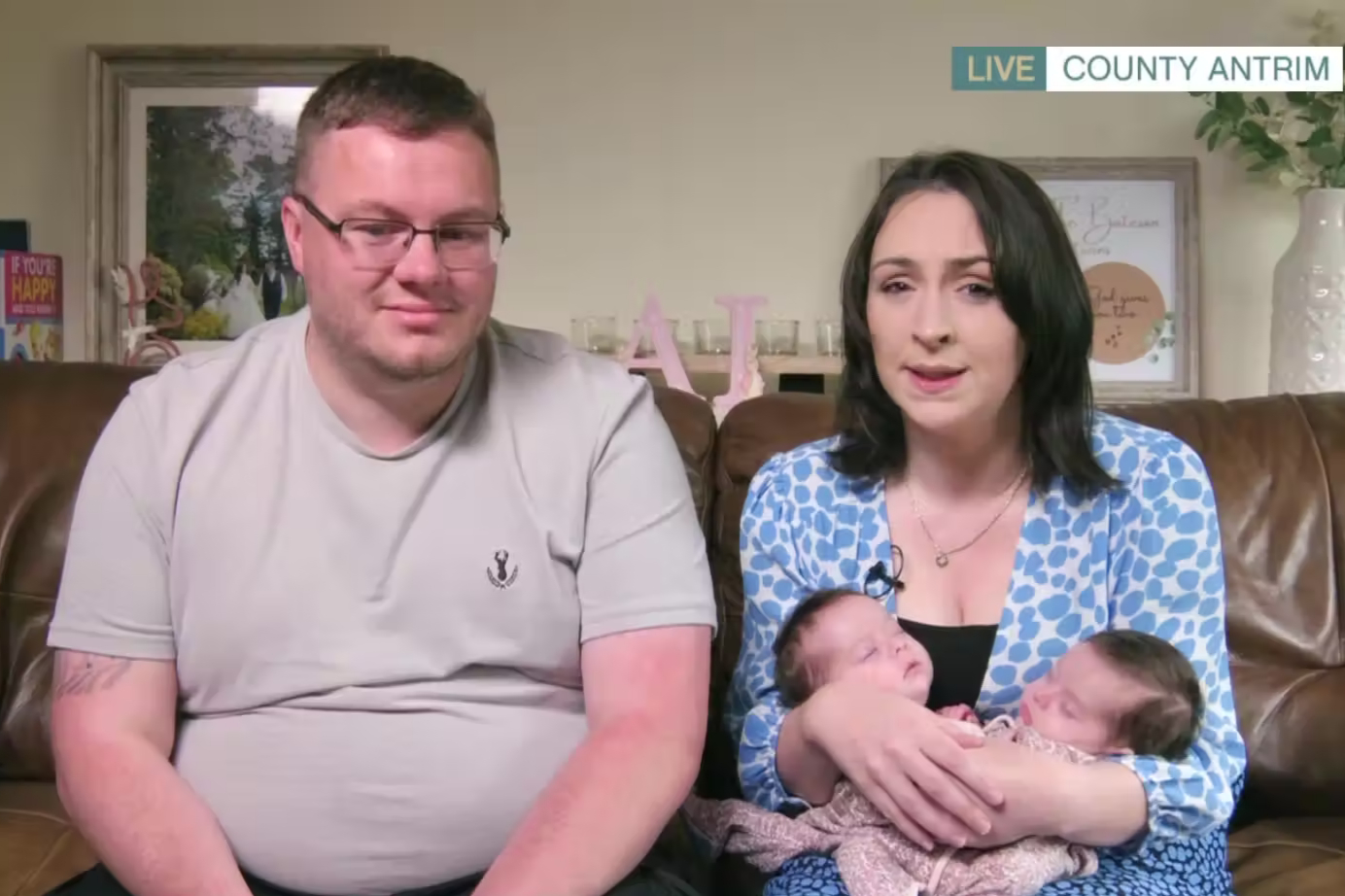 8 week old conjoined twins 