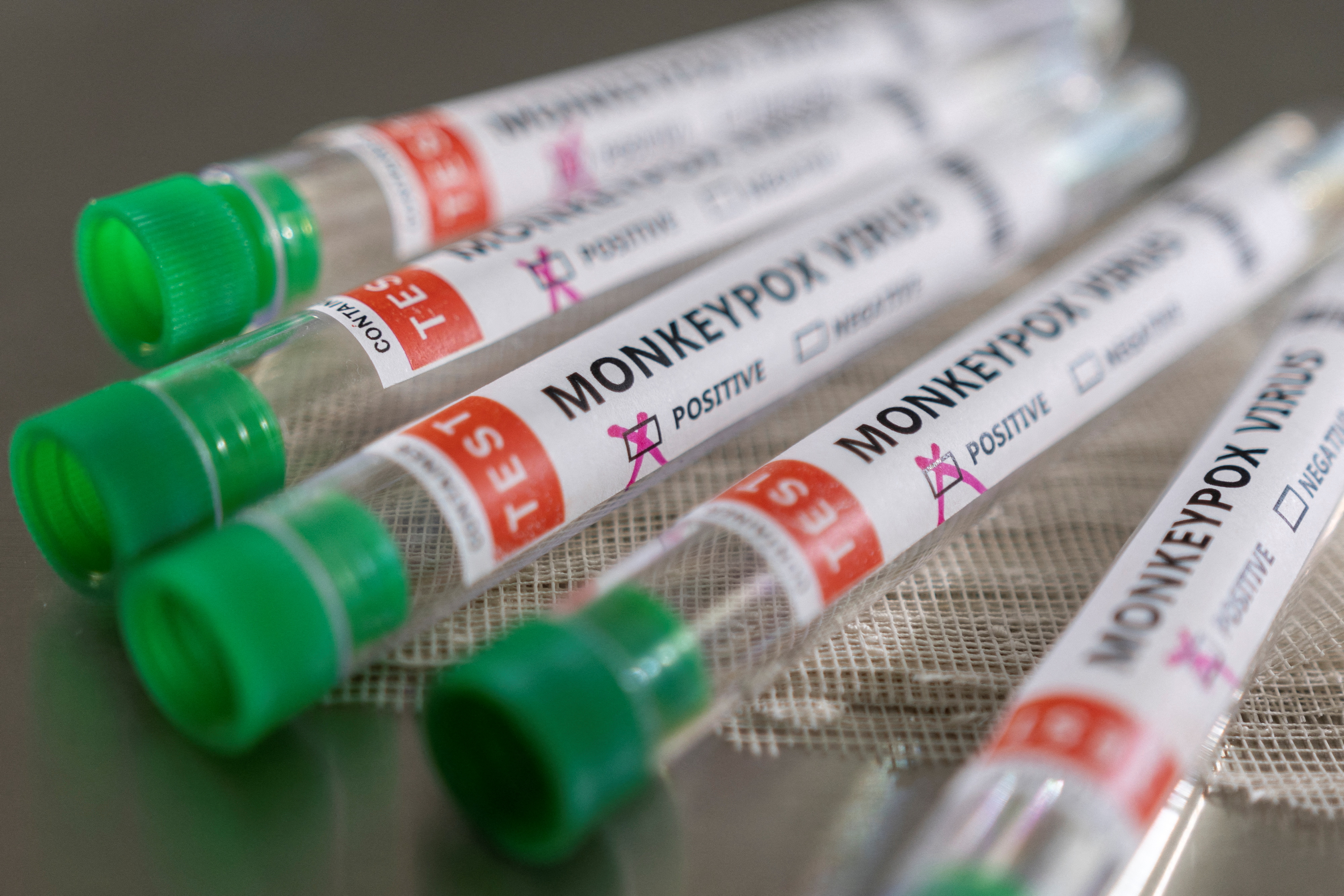 Evening Standard View: Time for vigilance, not panic on Monkeypox