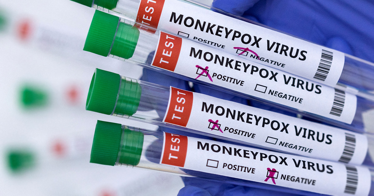FILE PHOTO: Illustration shows test tubes labelled "Monkeypox virus positive and negative\\