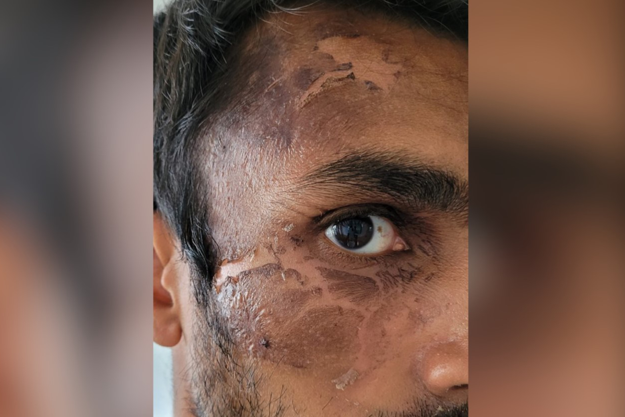 Racist thug who hurled boiling water at police officer avoids jail 