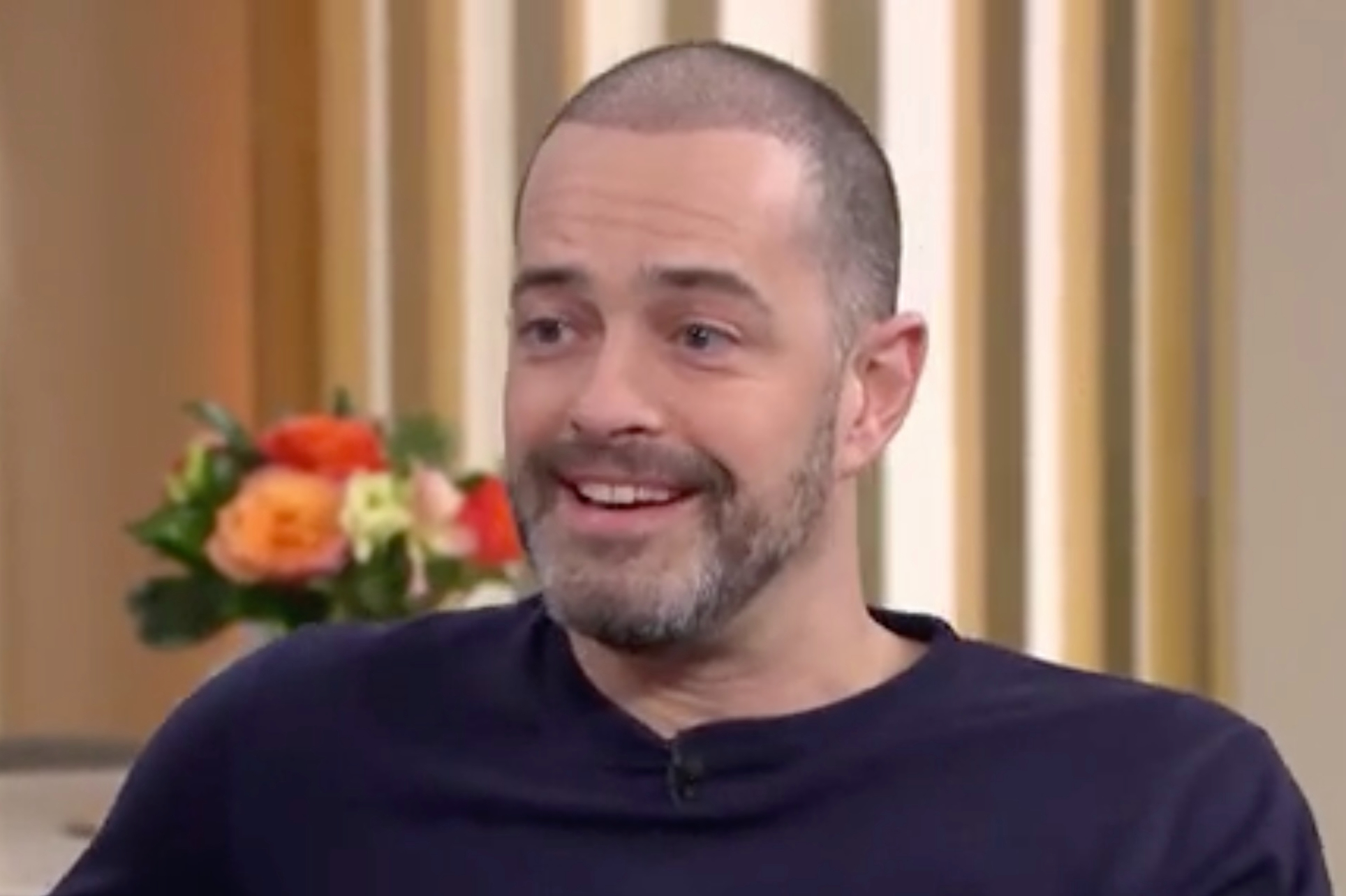 Lee Mead shows off results of his recent hair transplant on live TV 