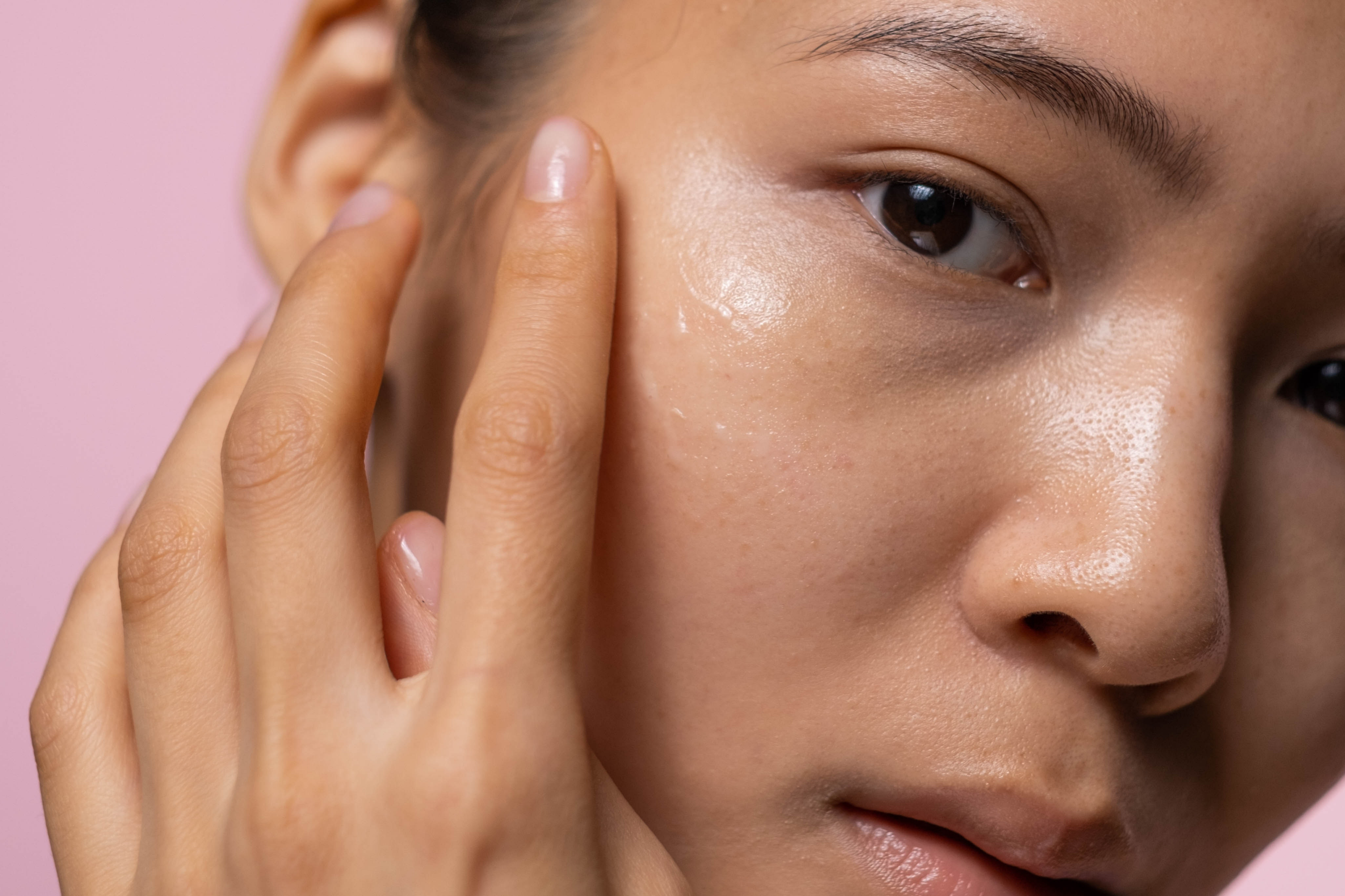 Best scar removal cream for stretch marks, acne scarring and keloids